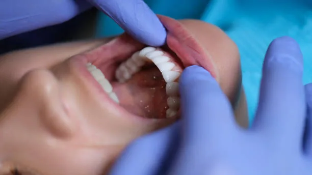 a person's hands examining a another person's teeth