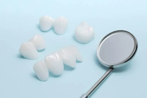 close-up view of a set of veneers with a concave dental mirror