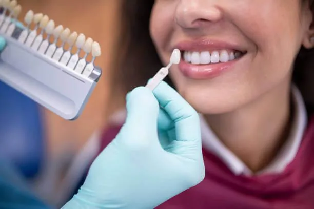 woman checking the color of her teeth with a palette tooth color sample