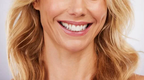 A woman smiling confidently with her beautiful set of teeth