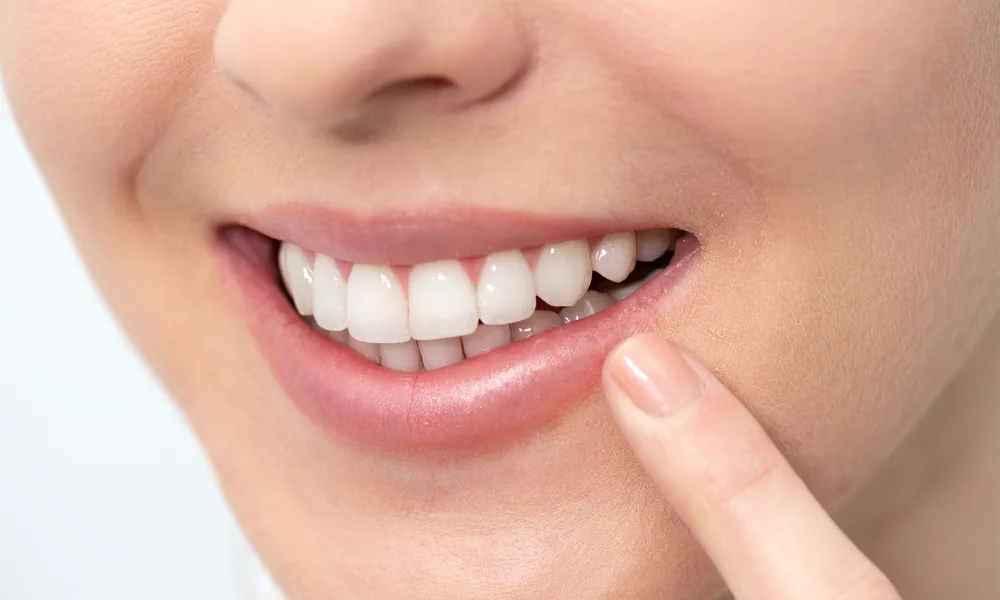 close up of bright white teeth showing results of teeth whitening treatme